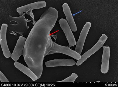 Third Generation Genome Sequencing Reveals That Endobacteria in Nematophagous Fungi Esteya vermicola Contain Multiple Genes Encoding for Nematicidal Proteins